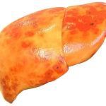 پکیج رایگان کبد چرب