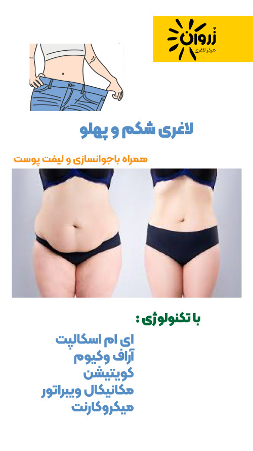 لاغری موضعی، لاغری شکم پهلو، لاغری باسن، کویتیشن ،آراف لاغری، EMS، فرمدهی لاغری، مرکز لاغری زروان، ستارخان 66921615،
