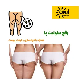 درمان سلولیت، سلولیت، سلولیت باسن، سلولیت پا، پوست ناصاف، کلینیک زروان ، کلینیک زروان غرب تهران، ستارخان 66921615