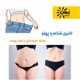 لاغری موضعی، لاغری شکم پهلو، لاغری باسن، کویتیشن ،آراف لاغری، EMS، فرمدهی لاغری، مرکز لاغری زروان، ستارخان 66921615،