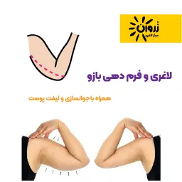 لاغری موضعی، لاغری شکم پهلو، لاغری باسن، کویتیشن ،آراف لاغری، EMS، فرمدهی لاغری، مرکز لاغری زروان، ستارخان 66921615،