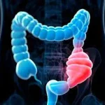 پکیج رایگان رفع یبوست