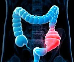 یبوست، رفع یبوست، درمان یبوست، میان وعده ضد یبوست، دمنوش گیاهی، پسیلیوم، فیبر، رژیم غذایی سالم، افزایش حرکات روده، نفخ، سلامت گوارش، چاقی،