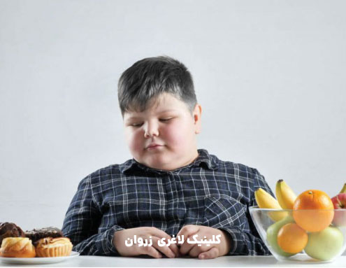 وزن نرمال کودک، رژیم لاغری کودک چاق، علت چاقی کودک ، درمان چاقی کودک چاق، برنامه غذایی کودک چاق، تغذیه در چاقی کودک،