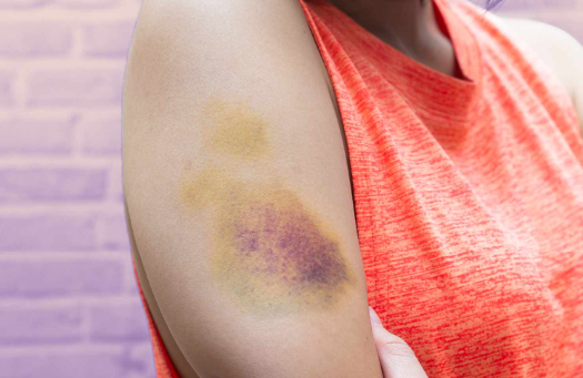 علائم کمبود مواد مغذی، بیماری ناشی از کمبود ریزمغذی‌ها، نقش مواد مغذی در بدن، نشانه‌های کمبود ویتامین و مواد معدنی، خستگی، ریزش مو، ضعف عضلانی و رژیم جبران کمبود