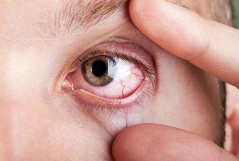 علائم کمبود مواد مغذی، بیماری ناشی از کمبود ریزمغذی‌ها، نقش مواد مغذی در بدن، نشانه‌های کمبود ویتامین و مواد معدنی، خستگی، ریزش مو، ضعف عضلانی و رژیم جبران کمبود