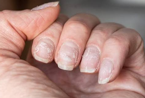 علائم کمبود مواد مغذی، بیماری ناشی از کمبود ریزمغذی‌ها، نقش مواد مغذی در بدن، نشانه‌های کمبود ویتامین و مواد معدنی، خستگی، ریزش مو، ضعف عضلانی و رژیم جبران کمبود