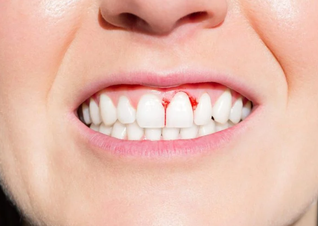 علائم کمبود مواد مغذی، بیماری ناشی از کمبود ریزمغذی‌ها، نقش مواد مغذی در بدن، نشانه‌های کمبود ویتامین و مواد معدنی، خستگی، ریزش مو، ضعف عضلانی و رژیم جبران کمبود